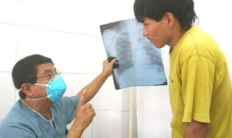 Perú registra una de las mayores tasas de tuberculosis extremadamente resistente en la región